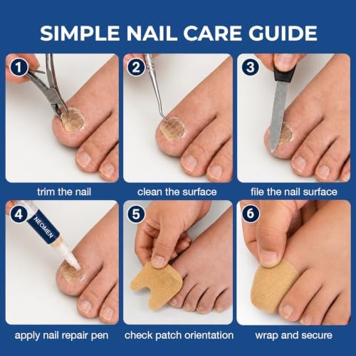 Neomen Nail Renewal Pen & Nail Tools Kit – Daily Care for Discolored, Damaged Nails, 2 Pens + Clipper Set