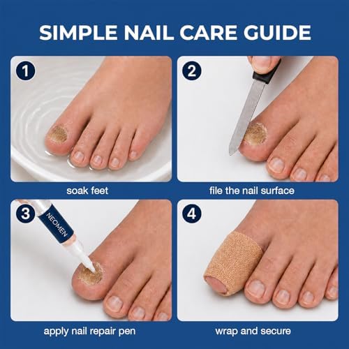 Neomen Nail Renewal Pen for Discolored, Damaged Nails – Toenails & Fingernails, 2 Count