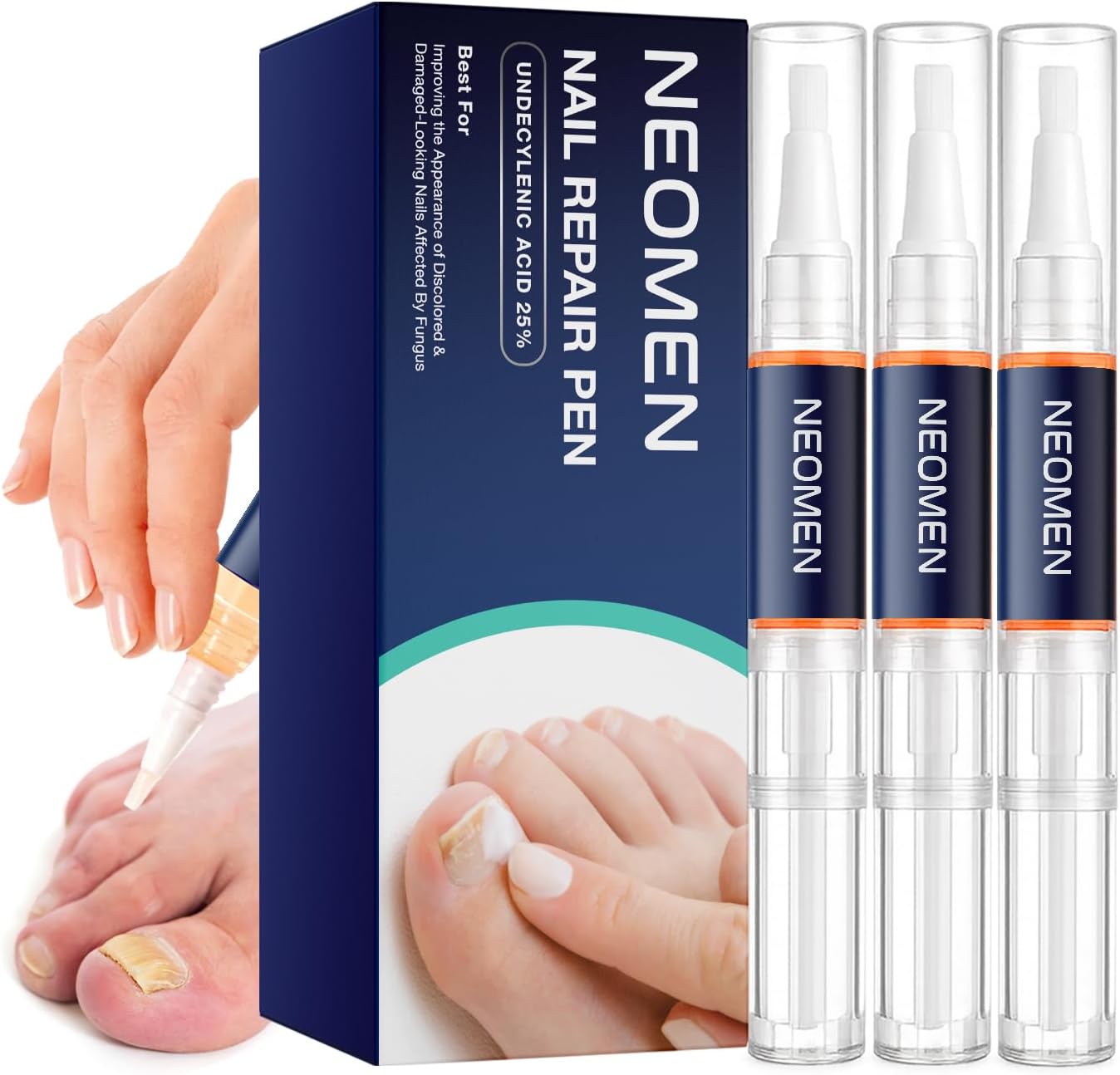 Neomen Nail Renewal Pen for Discolored, Damaged Nails – Toenails & Fingernails, 3 Count